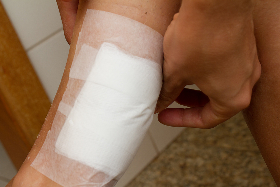 Dressing Burn Wound Gauze Bandage - McEwen Law Firm LTD Personal Injury Attorney